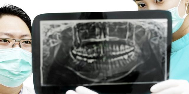 Dentist Holding X-Ray